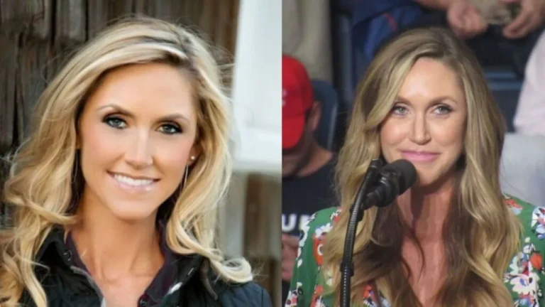 lara trump before and after